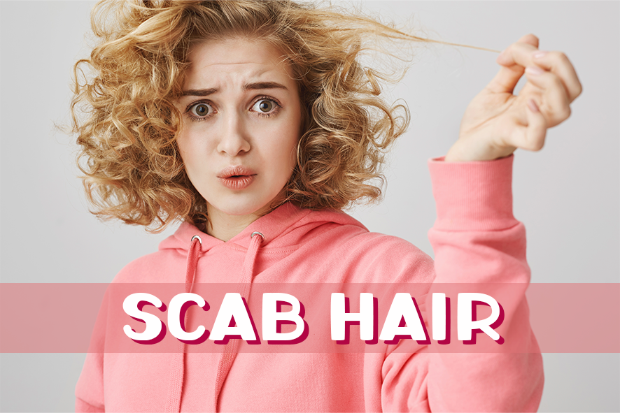 Me conta! Você já ouviu falar em Scab Hair?